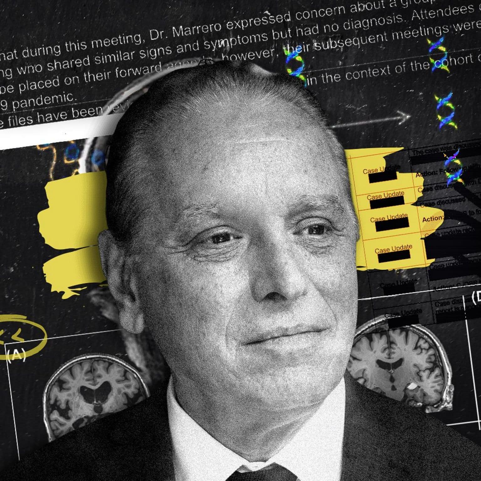 უცნობი ტვინის დაავადება კანადაში: 500 შემთხვევა, რეალური თუ არა?