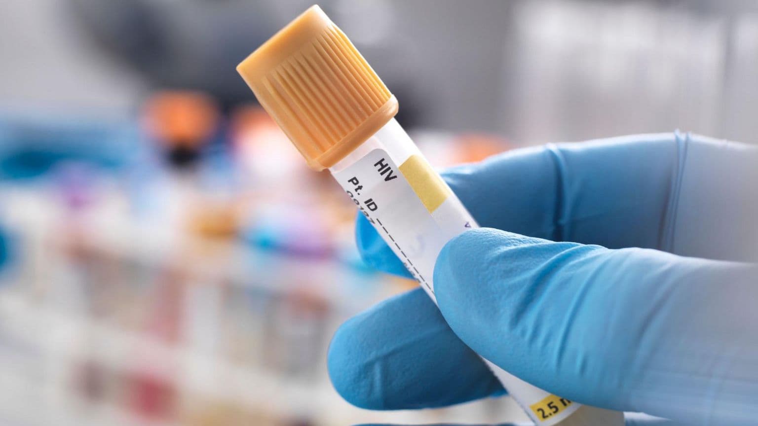 იტალიაში, მშობლებს ბრალად ედებათ შვილისთვის სერიოზული ზიანის მიყენება, რომელიც სავარაუდოდ აივ-ით იყო ინფიცირებული