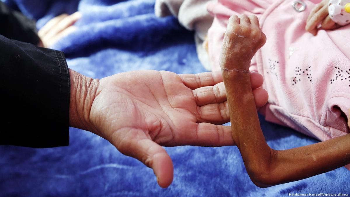 გაერო აფრთხილებს შიმშილის საფრთხის შესახებ აფრიკის 16 ქვეყანაში